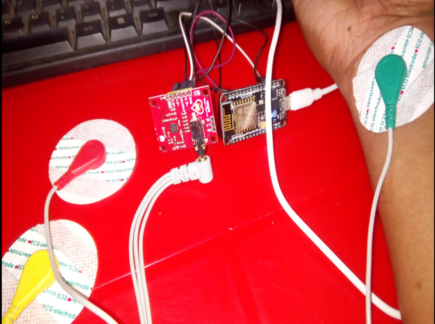 App Based ECG System